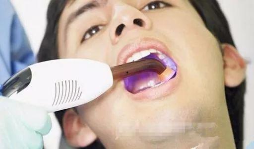 吃瓜拔牙新姿势视频大全,趣味视频大全盘点